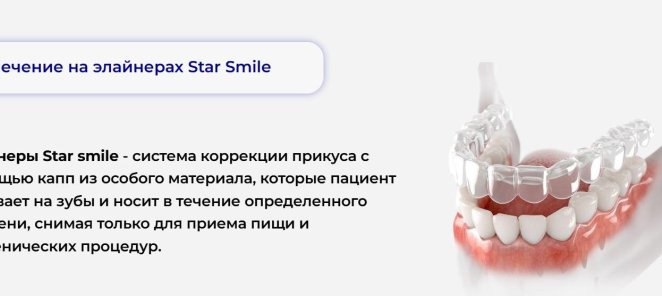 Элайнеры Star smile - система коррекции прикуса