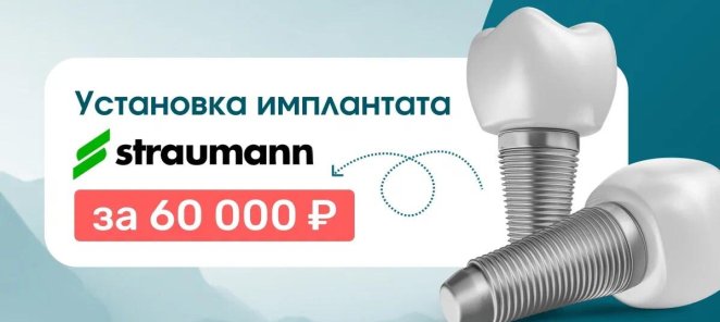 Установка имплантата Straumann по приятной цене!
