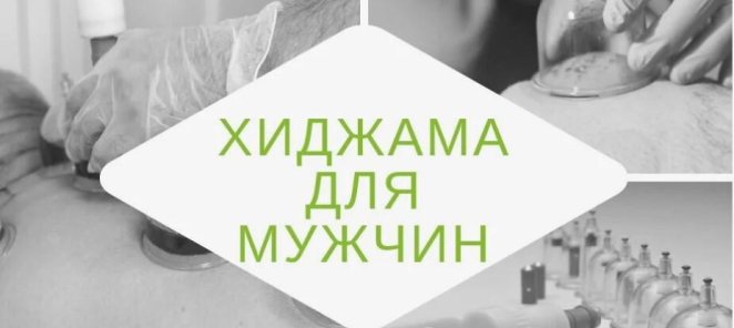 Скидка 20% на хиджаму для мужчин