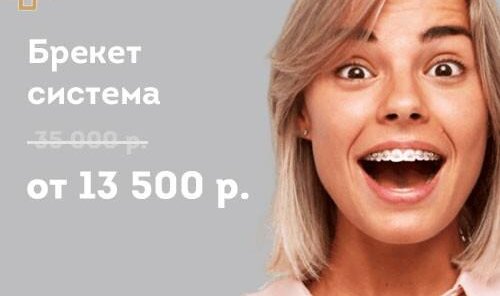 Брекет система от 13500р