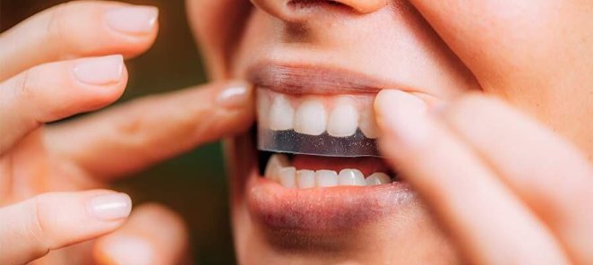 Скидка 30% на профессиональную гигиену полости рта