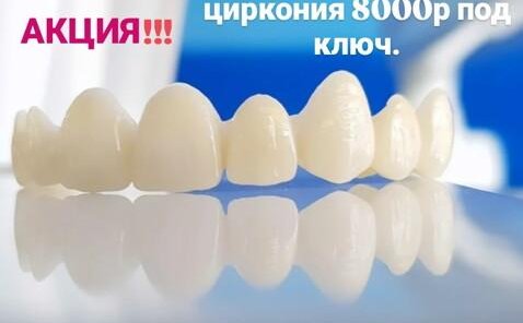 АКЦИЯ! Коронки из диоксида циркония 8000 р под ключ.