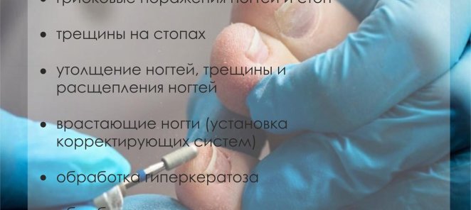 Подология