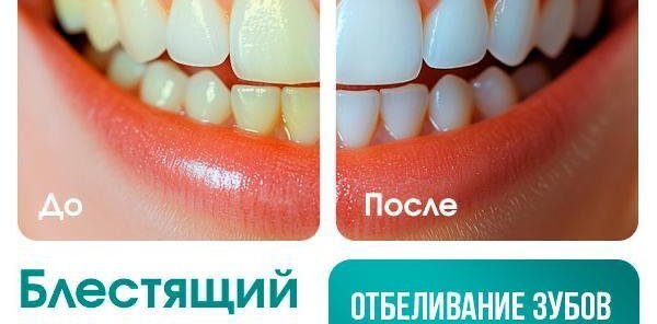 Отбеливание зубов со скидкой 50%