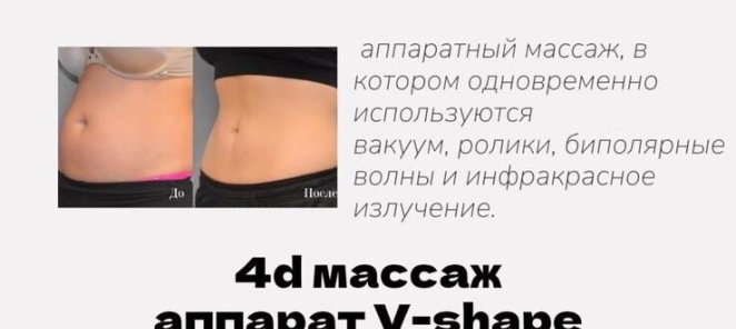 4d массаж на аппарате V-shape