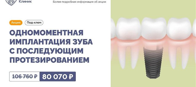 Имплантация зуба с протезированием
