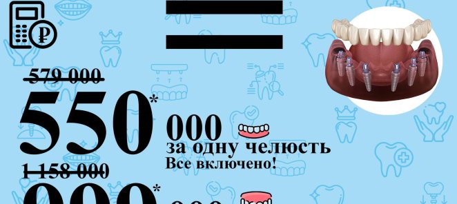 Имплантация все на 6ти
