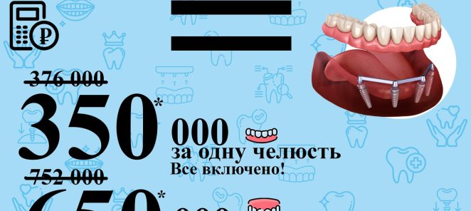 Имплантация все на 4х!