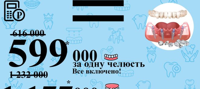 Имплантация все на 4х