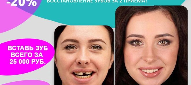 Весенние скидки на стоматологию. Имплантация зубов