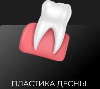 Пластика десны от 7000 руб.