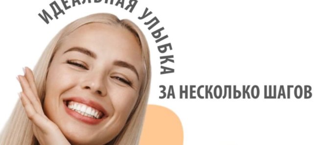 В клинике «Апрель» устанавливаем керамические виниры