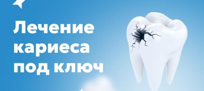 Лечение кариеса под ключ