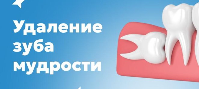 Удаление зуба мудрости