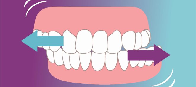Лечение бруксизма в Best clinic в Краснодаре
