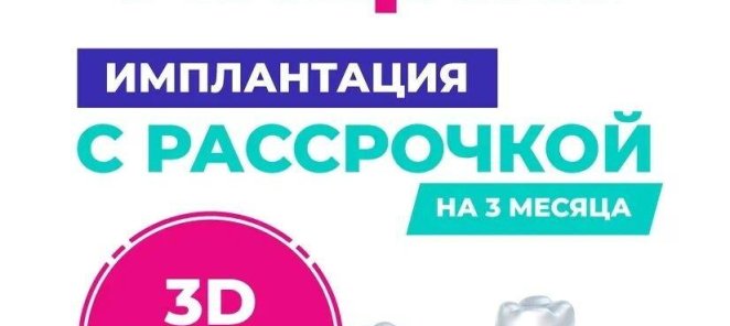 Имплантация с рассрочкой + 3D снимок в подарок