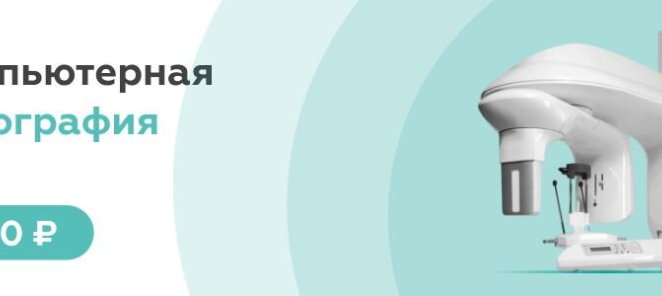 Компьютерная томография за 990 рублей