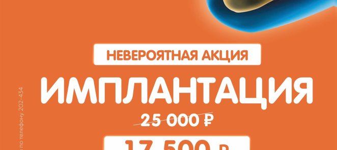 Имплантация зубов со скидкой!