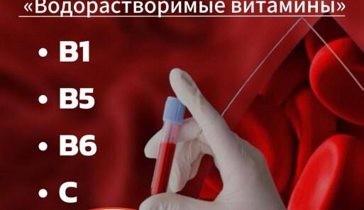 Check - up 