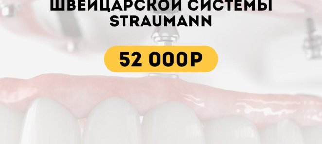 Имплантация с использованием швейцарской системы