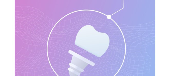 Имплант Osstem 21900 вместо 24900: ваша выгода 3000 руб
