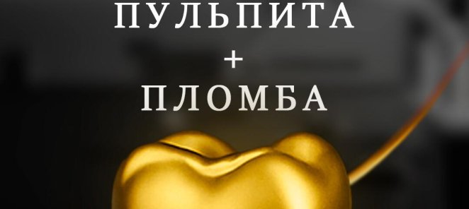 Лечение пульпита + пломба от 10000 руб.