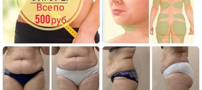 Коррекция фигуры – ВСЕГО по 500 рублей!