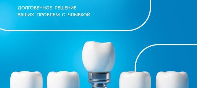Имплантация в стоматологии 