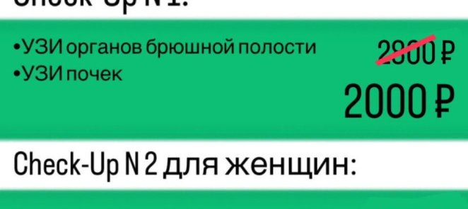 Выбери Check-Up для себя!