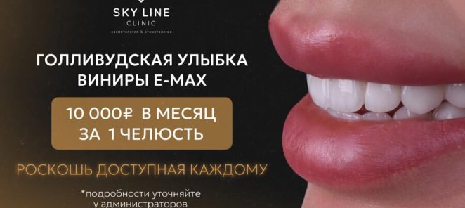 Виниры E-max за 10.000р в мес.