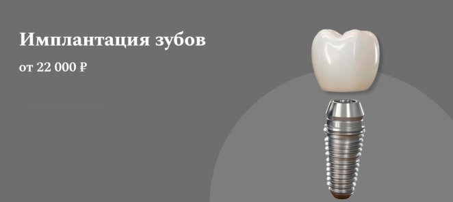 Имплантация зубов от 22000 руб
