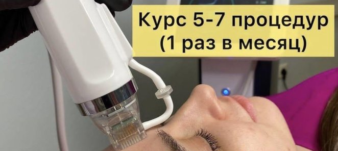 Микроигольчатый RF-лифтинг