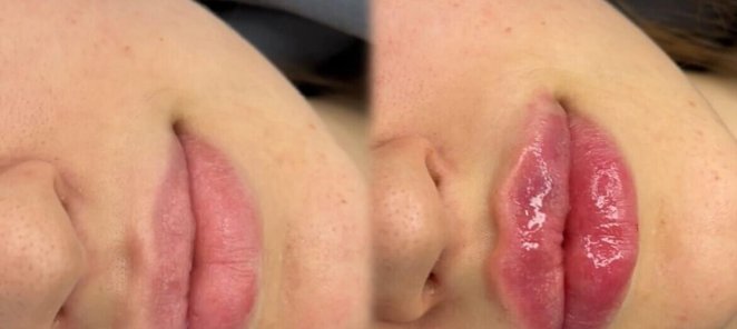 💋Губы + Сияние по специальной цене🤞