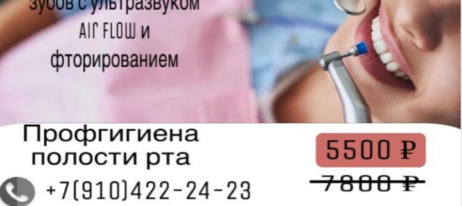 Акция на профессиональную гигиену