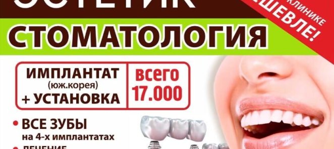 Имплантация 17.000 руб