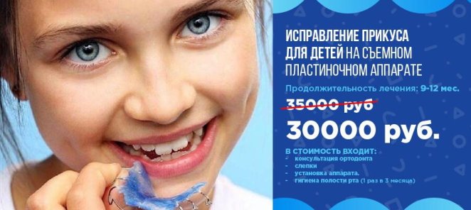 Ортодонтическое лечение на съемном пластиночном аппарате