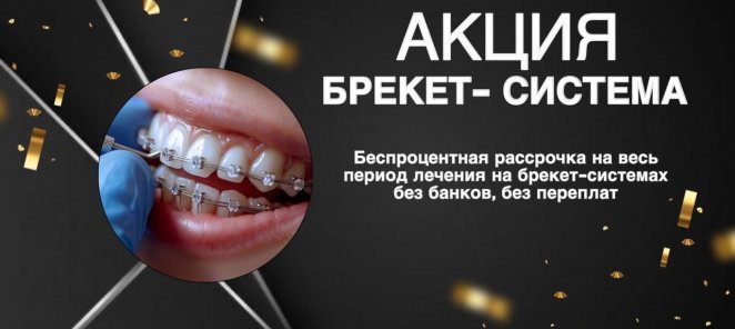 Брекет-система в рассрочку