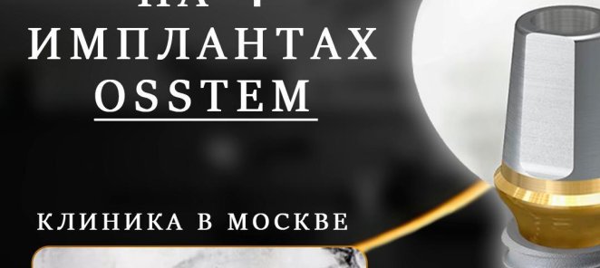 Всё на 4 - х имплантах Osstem
