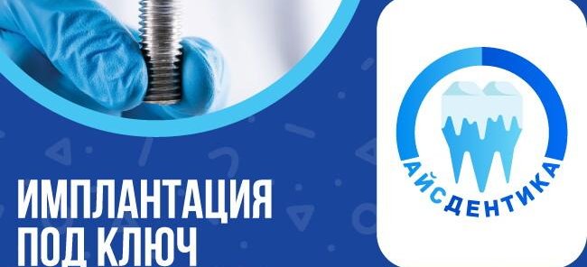 Имплантация под ключ