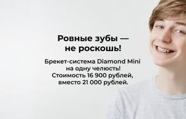 Ровные зубы всего за 16900 рублей!