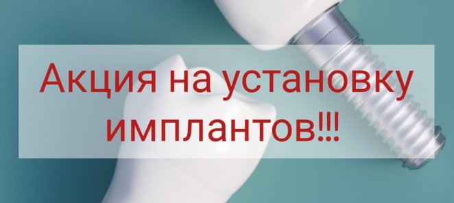 Акционное предложение на имплантацию зубов