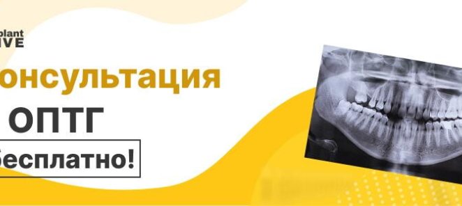 Бесплатная консультация + ОПТГ