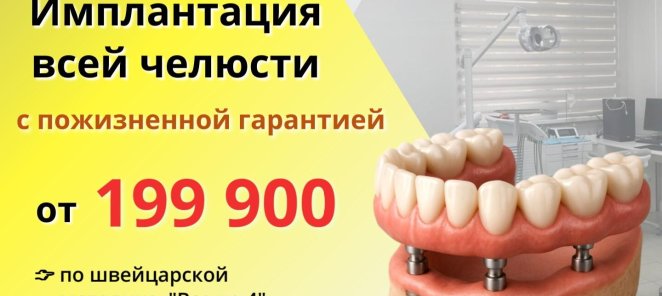Имплантация всей челюсти