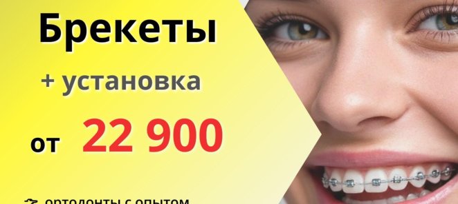 Брекеты с установкой 22900₽