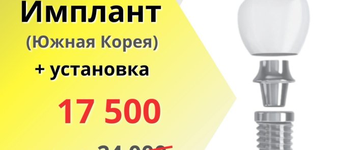 Имплант + установка =17 500 р