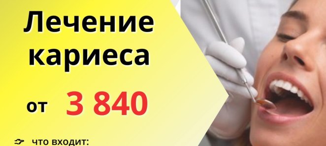 Лечение кариеса от 3840 руб