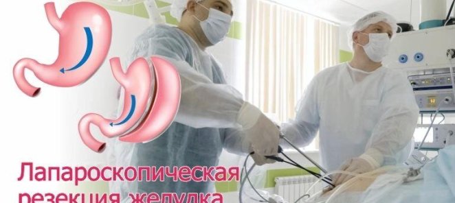 Прием бариатрического хирурга