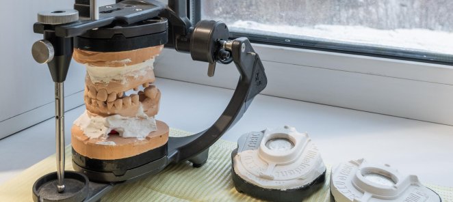 Исправление прикуса. Диагностика и 3D сканирование зубов