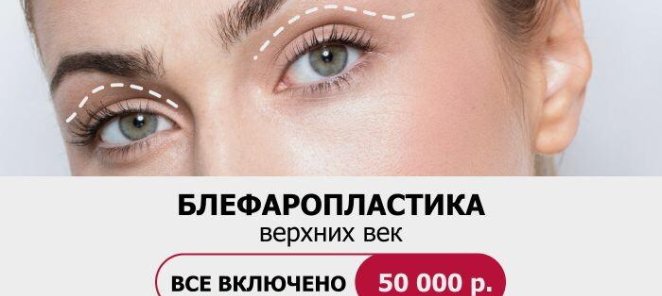 Блефаропластика верхних век