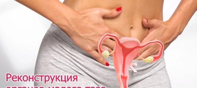 Прием по реконструкции тазового дна